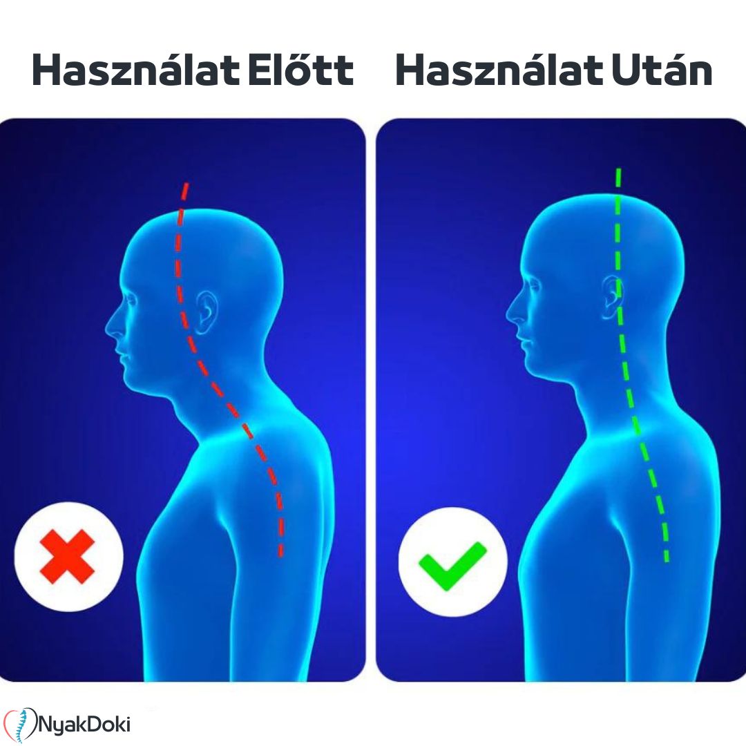 NyakDoki Elektromos Masszírozó Nyaki- és Vállfájdalmakra